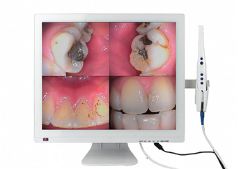 M-998 WIFI口腔观察仪+19寸液晶屏(显示器一体机)