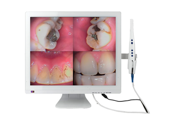 M-998 WIFI口腔观察仪+19寸液晶屏(显示器一体机)