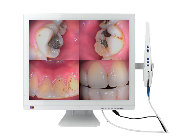 M-978 WIFI口腔观察仪+17寸液晶屏(显示器一体机）