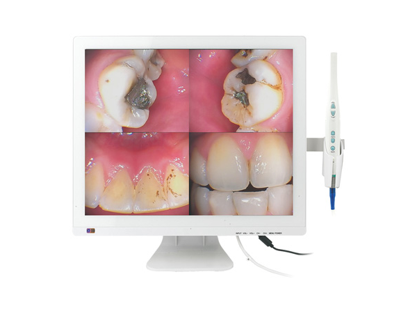 M-978V 17寸口腔观察仪一体机